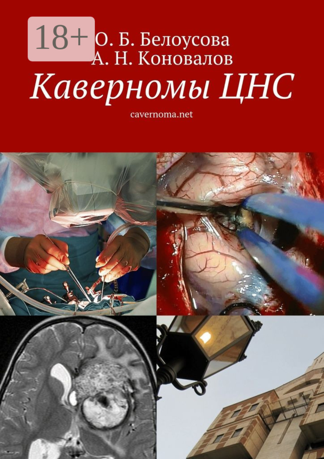Обложка книги «Каверномы ЦНС. cavernoma.net»