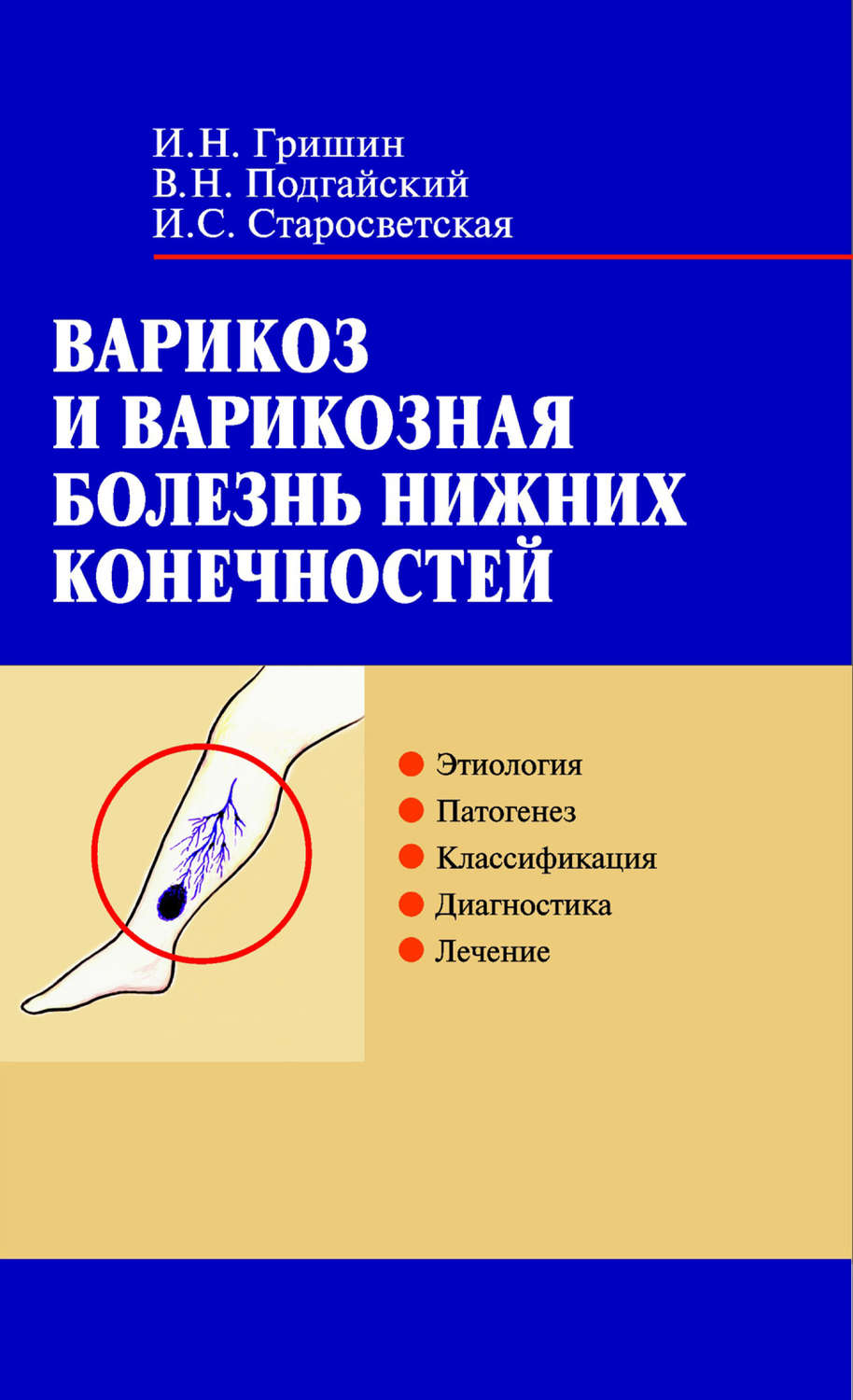 Обложка книги «Варикоз и варикозная болезнь нижних конечностей»