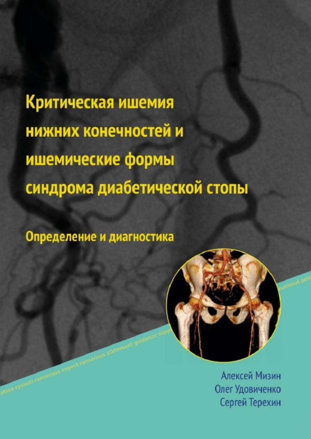 Обложка книги «Критическая ишемия нижних конечностей и ишемические формы синдрома диабетической стопы»