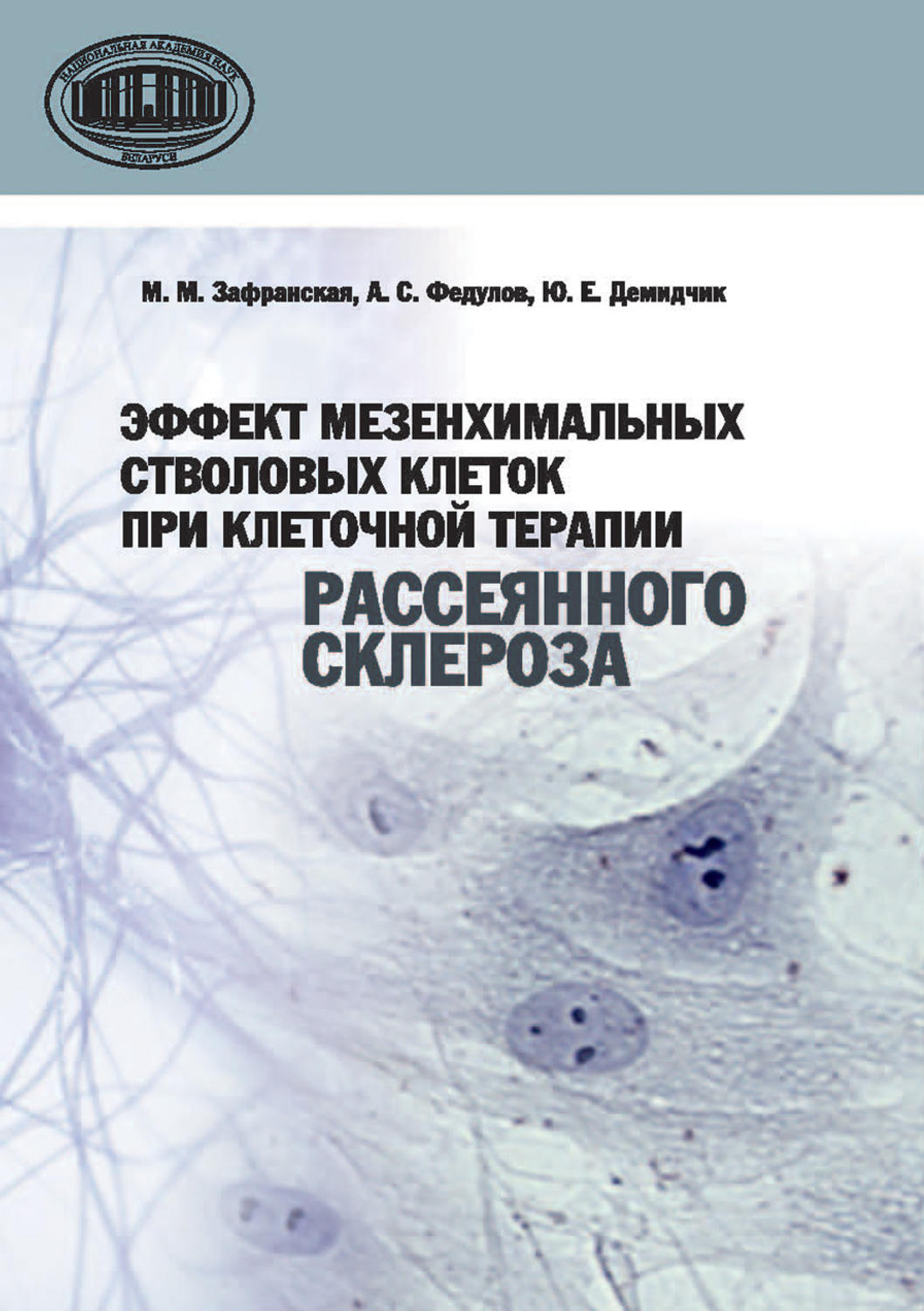 Обложка книги «Эффект мезенхимальных стволовых клеток при клеточной терапии рассеянного склероза»