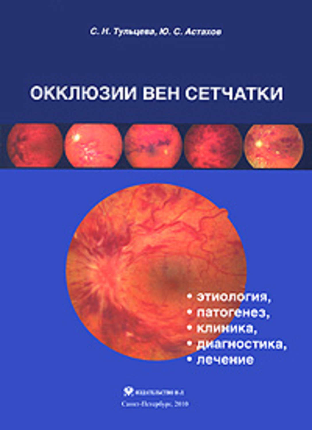 Обложка книги «Окклюзии вен сетчатки (этиология, патогенез, клиника, диагностика, лечение)»