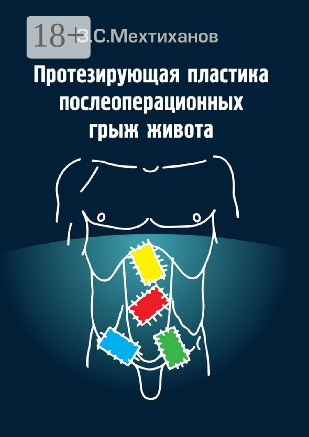 Обложка книги «Протезирующая пластика послеоперационных грыж живота»