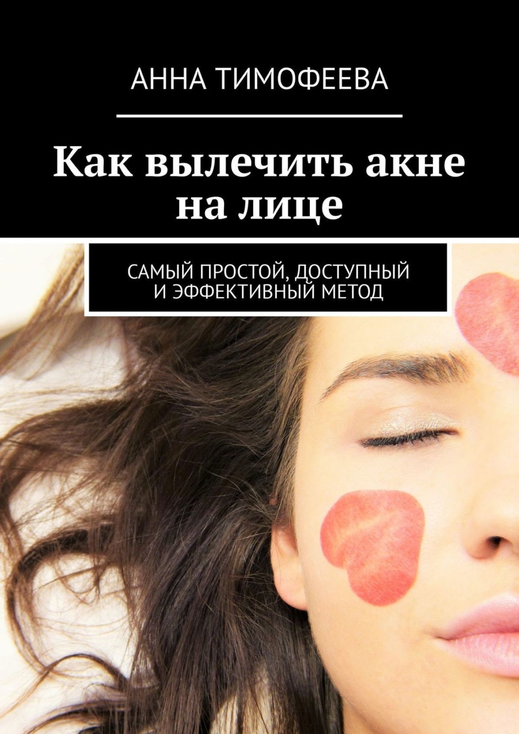 Обложка книги «Как вылечить акне на лице. Самый простой, доступный и эффективный метод»