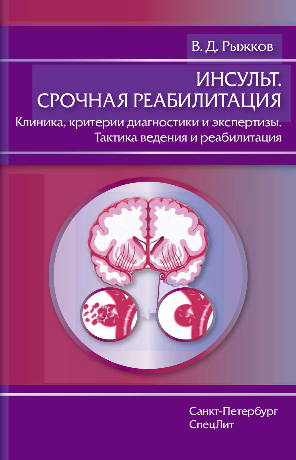Обложка книги «Инсульт. Срочная реабилитация. Клиника, критерии диагностики и экспертизы. Тактика ведения и реабилитация»