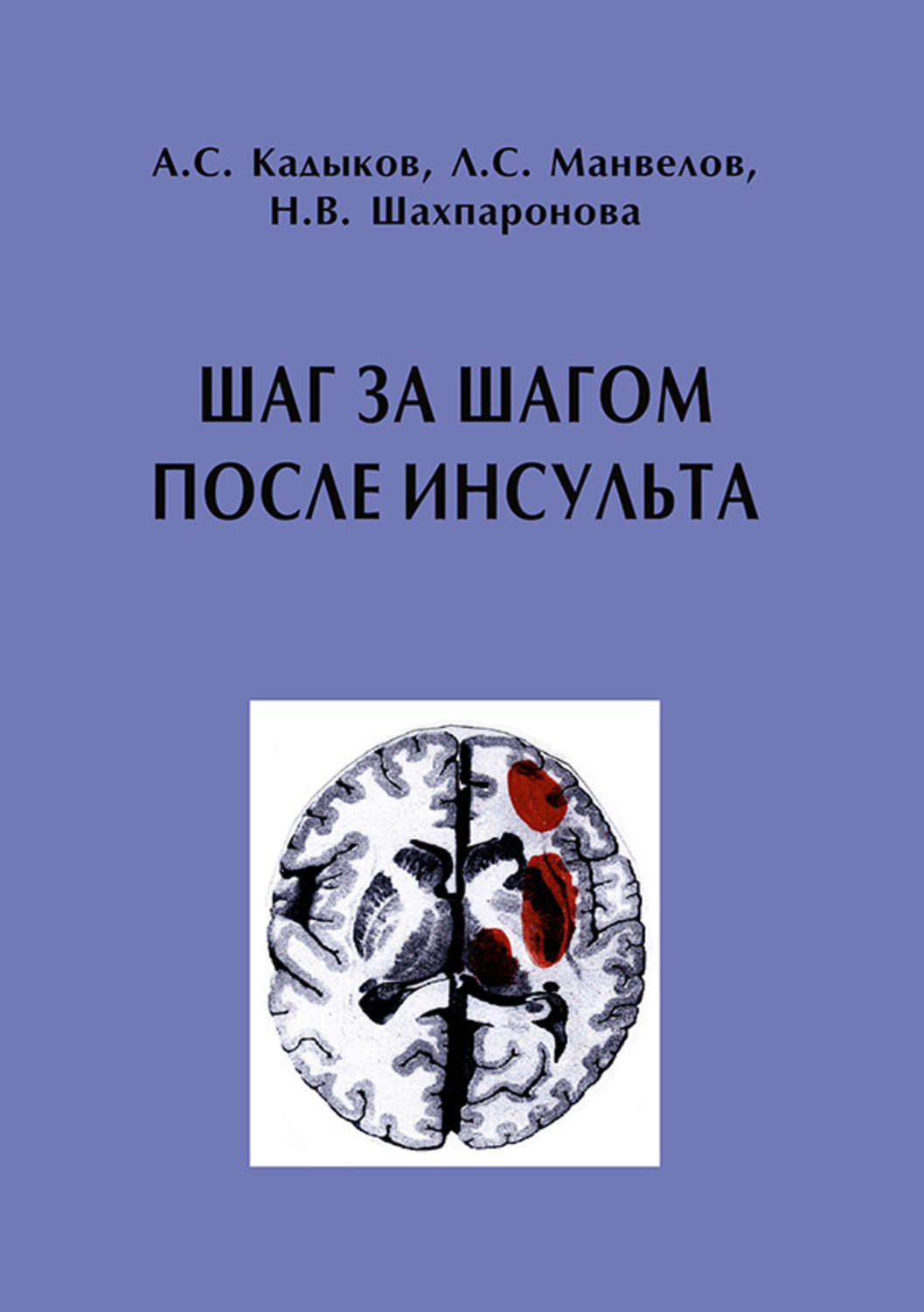 Обложка книги «Шаг за шагом после инсульта: Пособие для пациентов и их родственников»