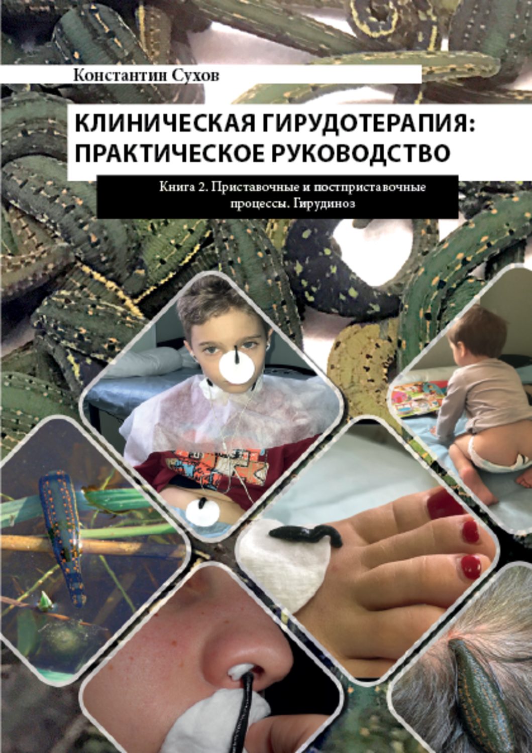 Обложка книги «Клиническая гирудотерапия: практическое руководство. Книга 2 Приставочные и постприставочные процессы. Гирудиноз»