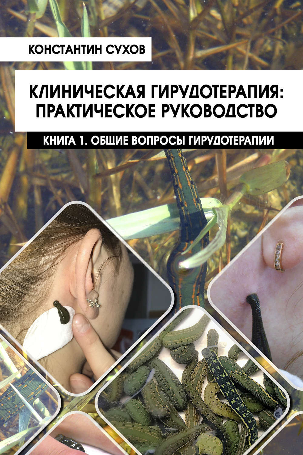 Обложка книги «Клиническая гирудотерапия: практическое руководство. Книга 1. Общие вопросы гирудотерапии»