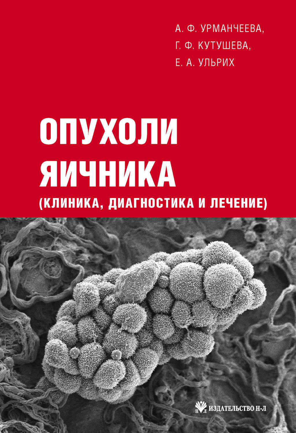 Обложка книги «Опухоли яичника: клиника, диагностика и лечение»
