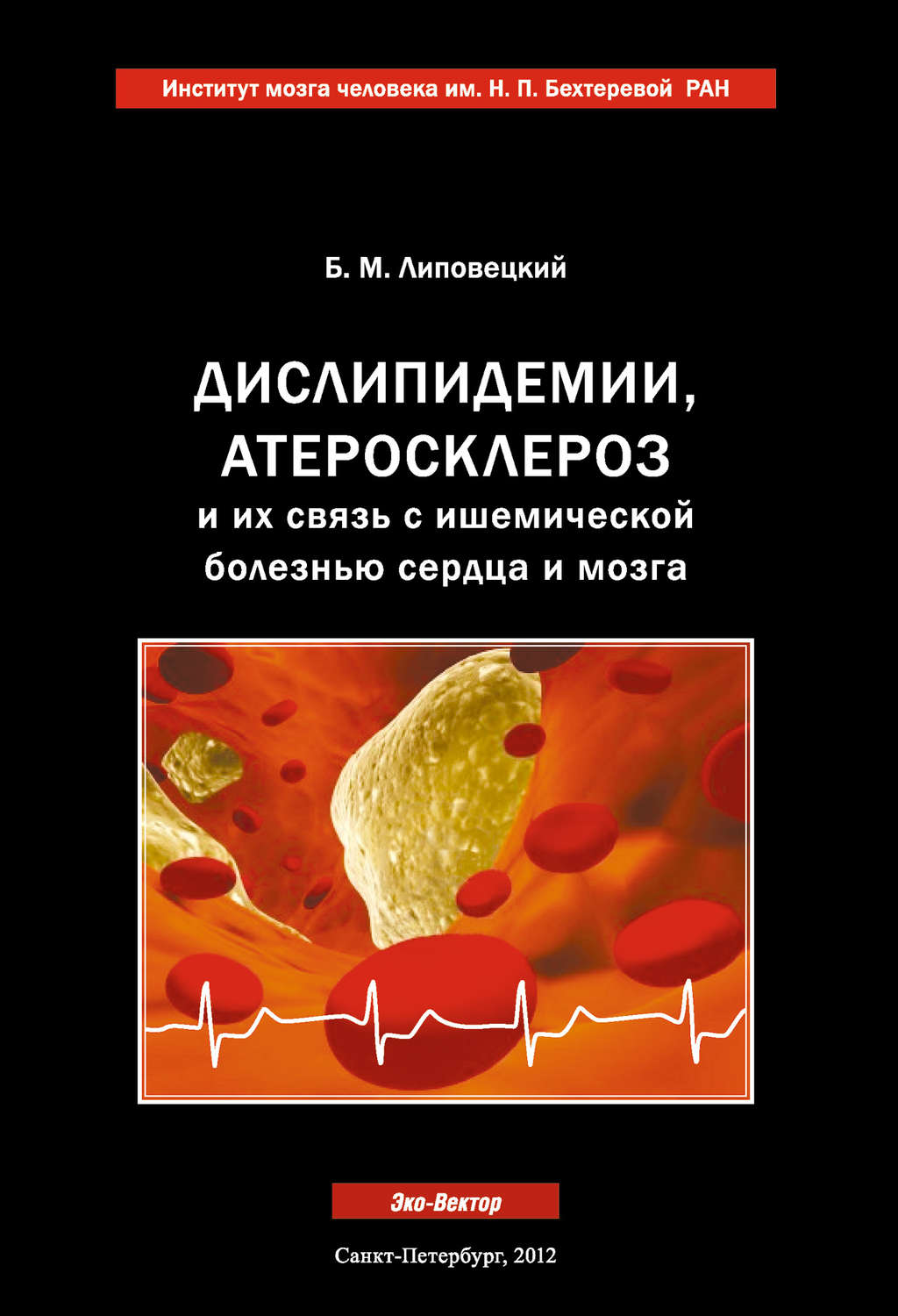 Обложка книги «Дислипидемии, атеросклероз и их связь с ишемической болезнью сердца и мозга»