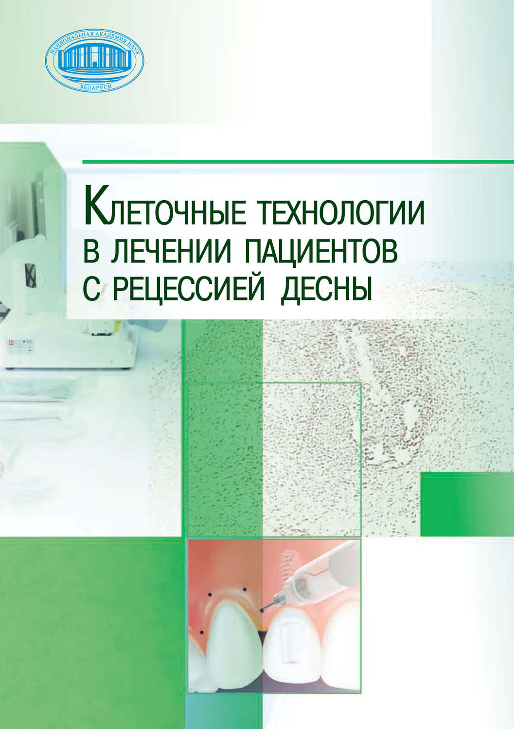 Обложка книги «Клеточные технологии в лечении пациентов с рецессией десны»