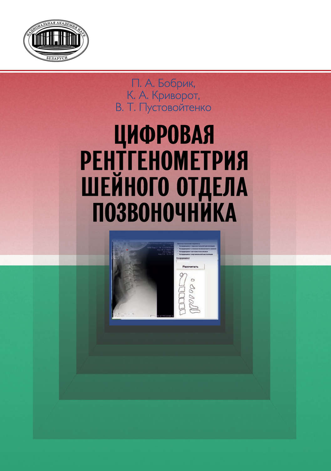 Обложка книги «Цифровая рентгенометрия шейного отдела позвоночника»