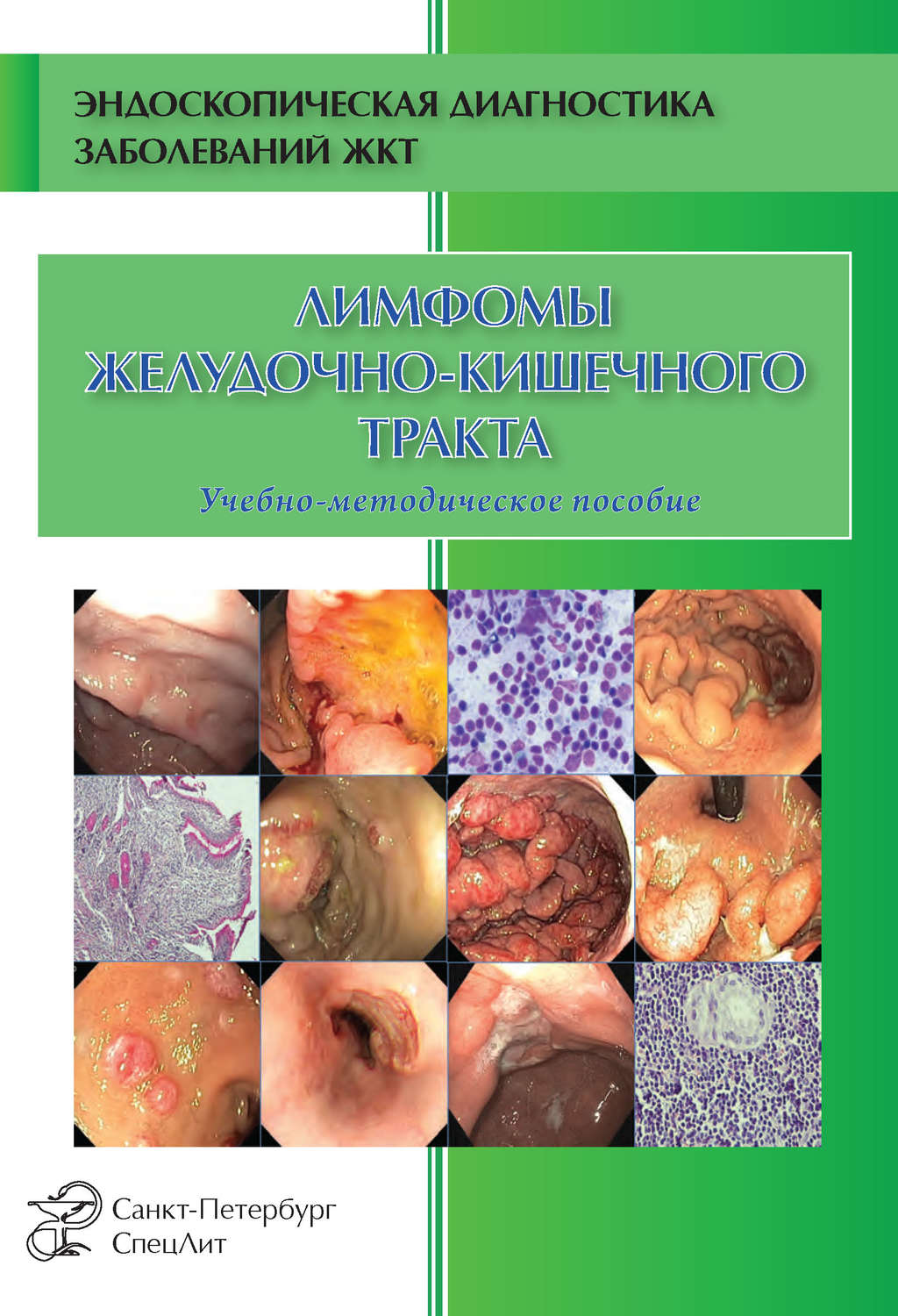 Обложка книги «Лимфомы желудочно-кишечного тракта»
