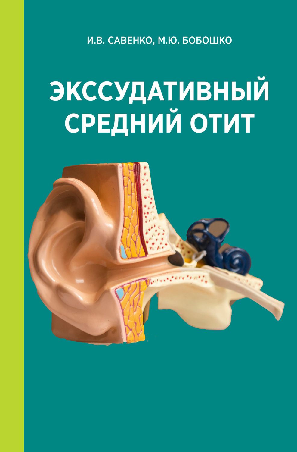 Обложка книги «Экссудативный средний отит»