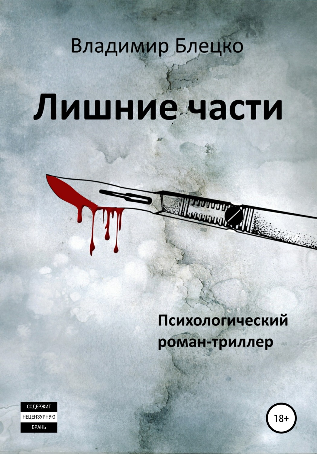 Обложка книги «Лишние части»