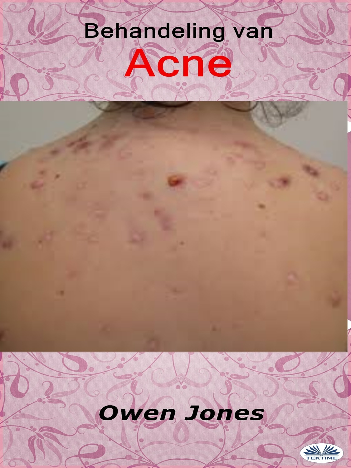 Обложка книги «Behandeling Van Acne»