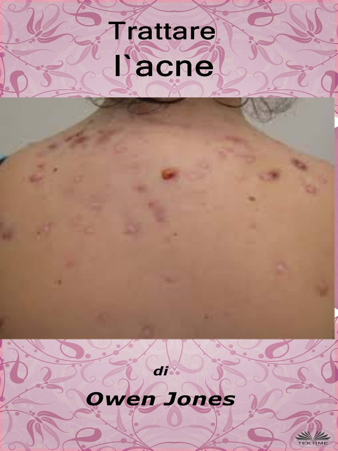 Обложка книги «Trattare L'Acne»