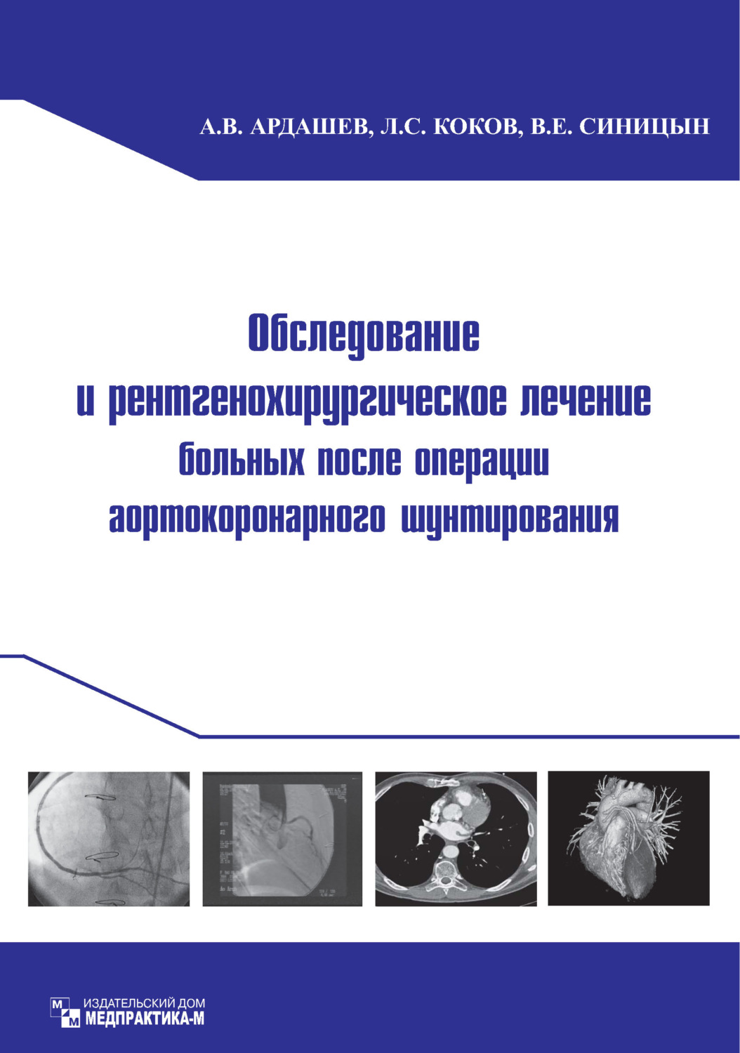 Обложка книги «Обследование и рентгенохирургическое лечение больных после операции аортокоронарного шунтирования»