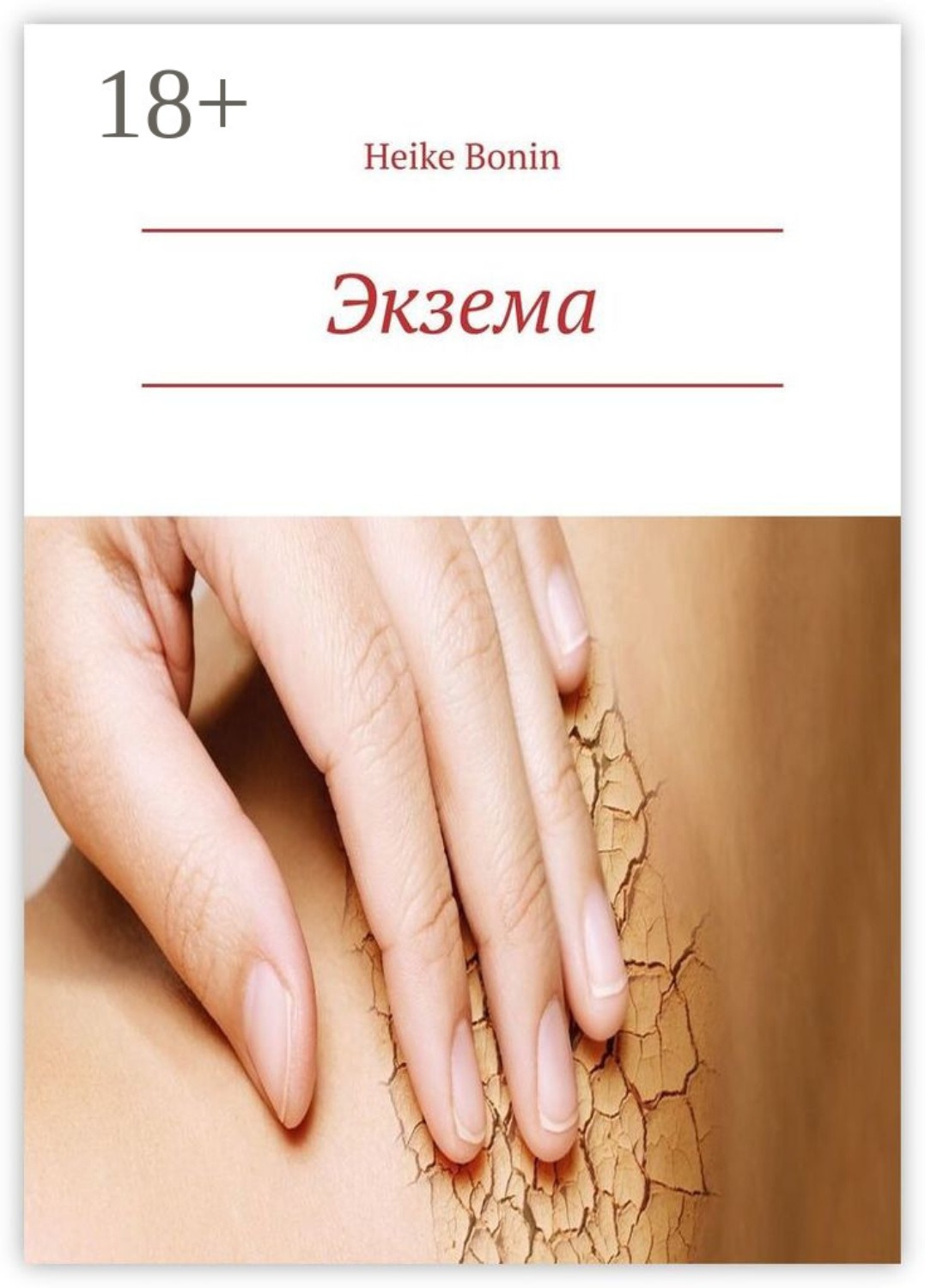 Обложка книги «Экзема»