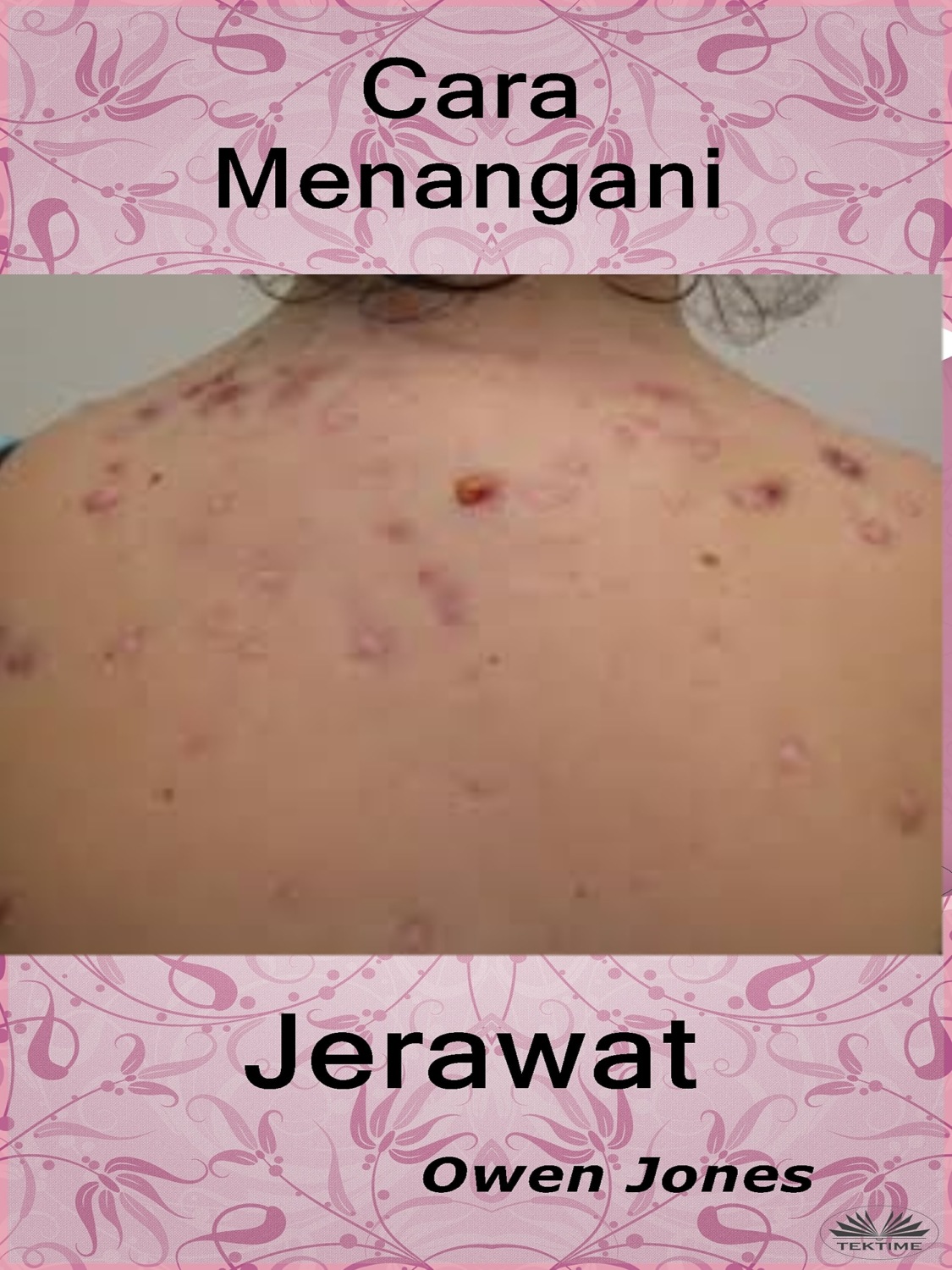 Обложка книги «Cara Menangani Jerawat»