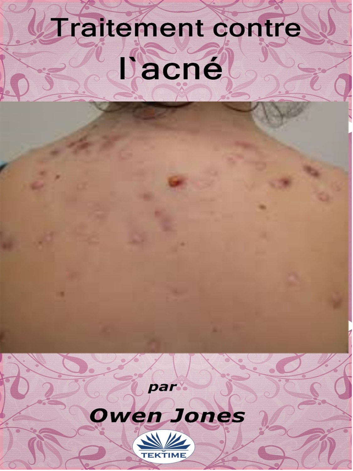 Обложка книги «Traitement Contre L'Acné»