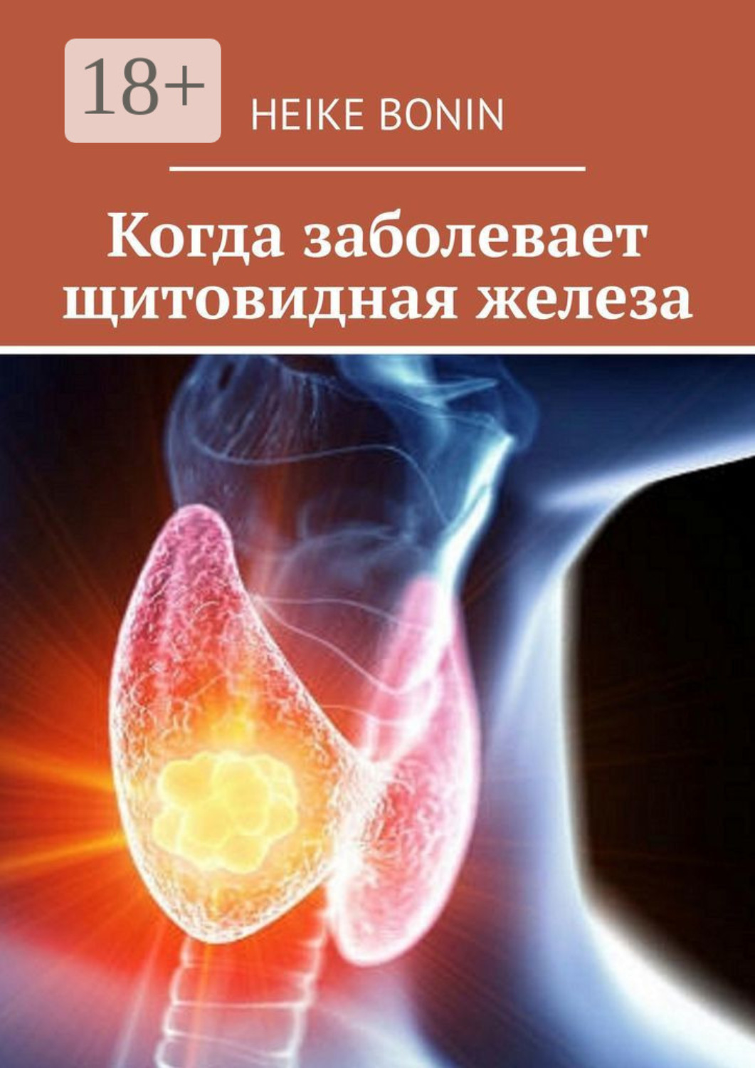 Обложка книги «Когда заболевает щитовидная железа»