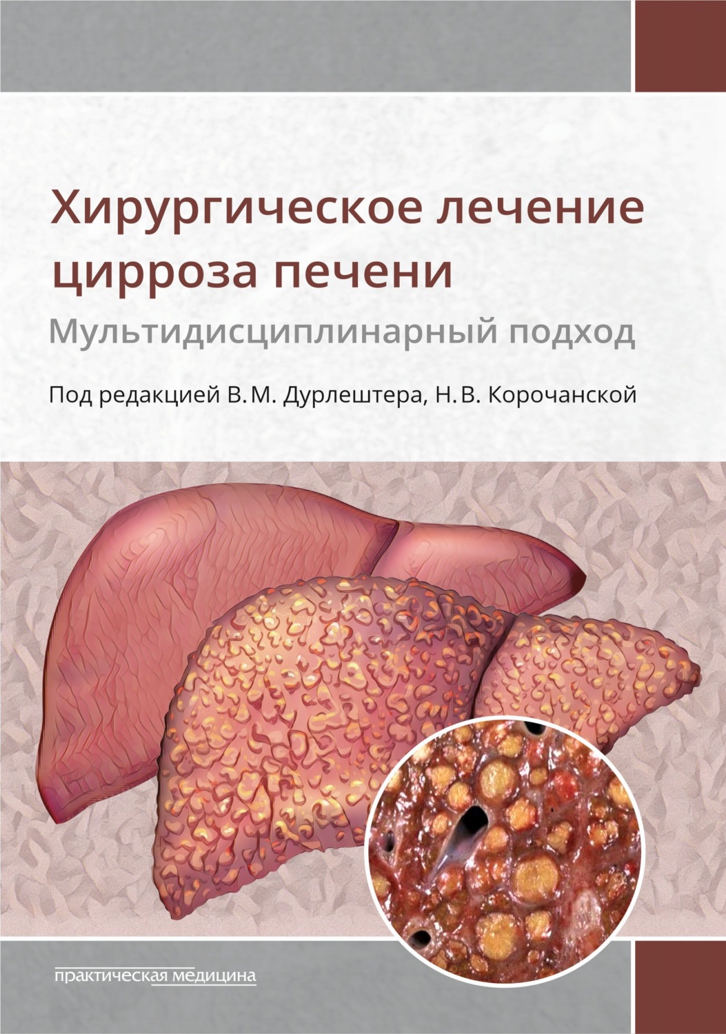 Обложка книги «Хирургическое лечение цирроза печени. Мультидисциплинарный подход»