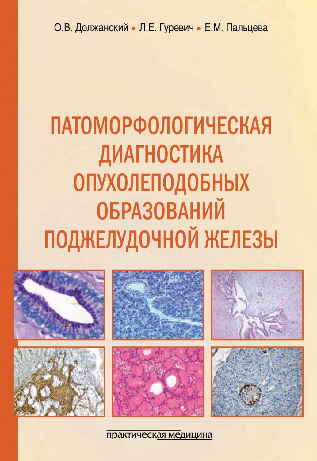 Обложка книги «Патоморфологическая диагностика опухолеподобных образований поджелудочной железы. Руководство для врачей»