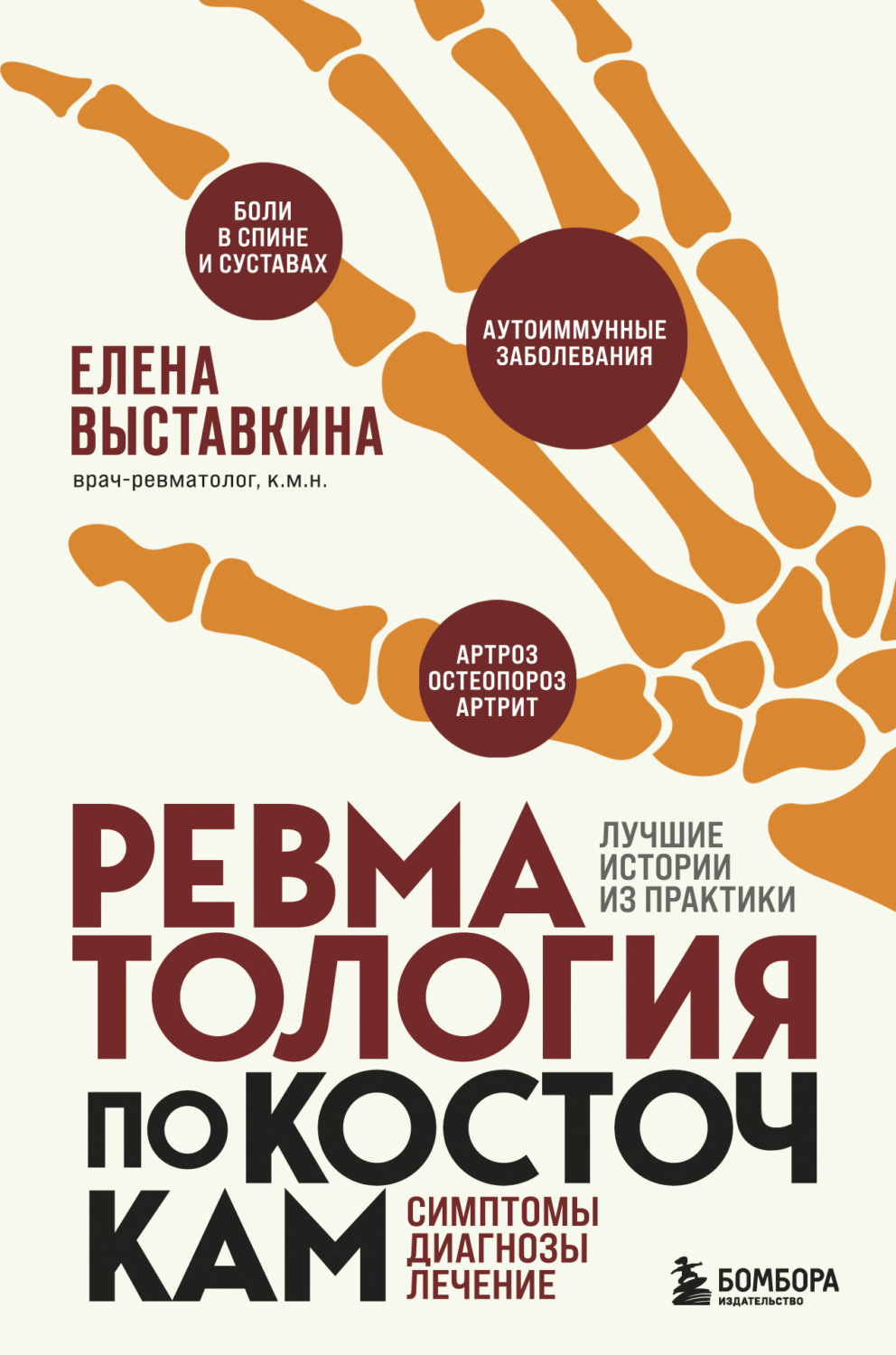 Обложка книги «Ревматология по косточкам. Симптомы, диагнозы, лечение»