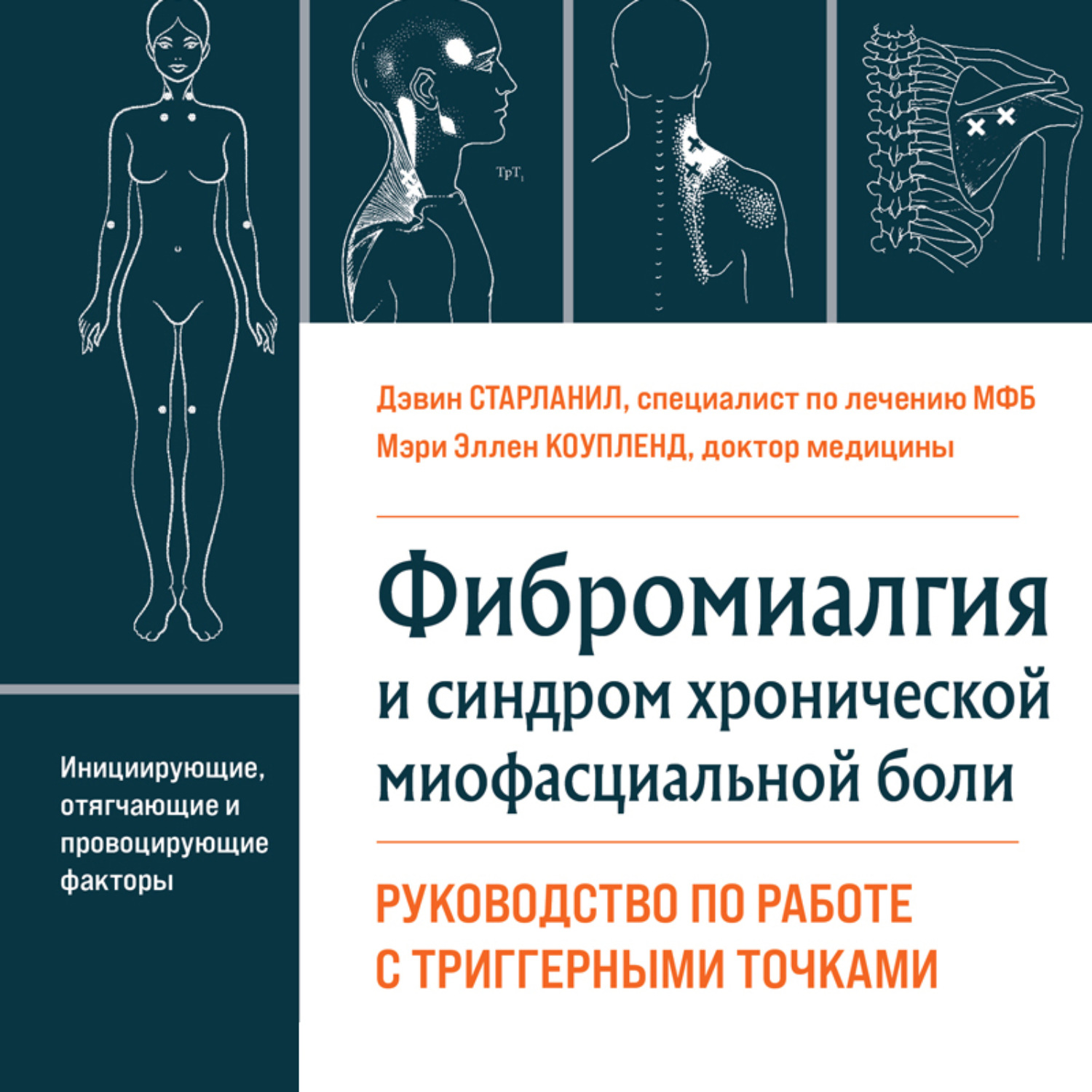 Обложка книги «Фибромиалгия и синдром хронической миофасциальной боли. Руководство по работе с триггерными точками»