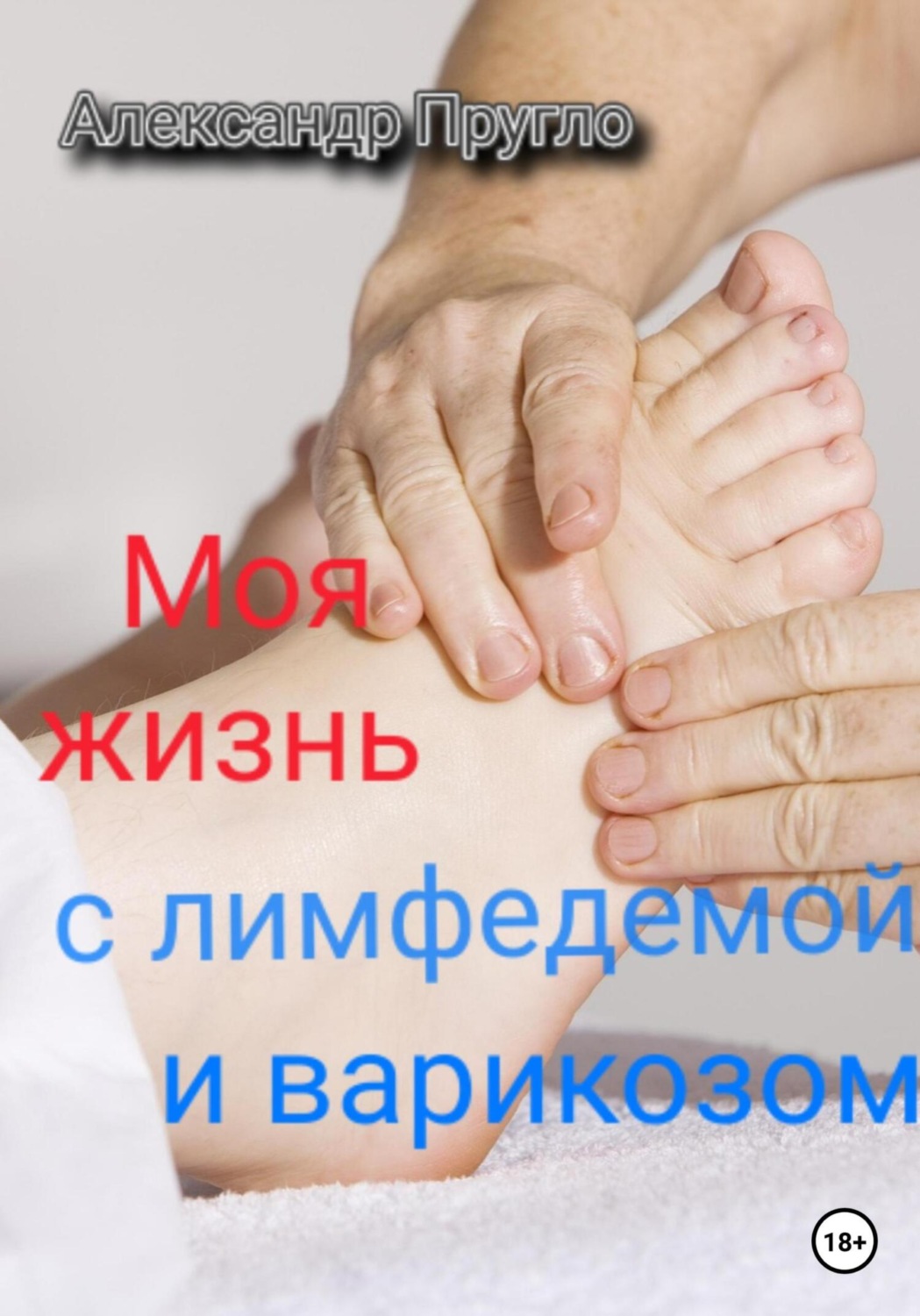 Обложка книги «Моя жизнь с лимфедемой и варикозом»