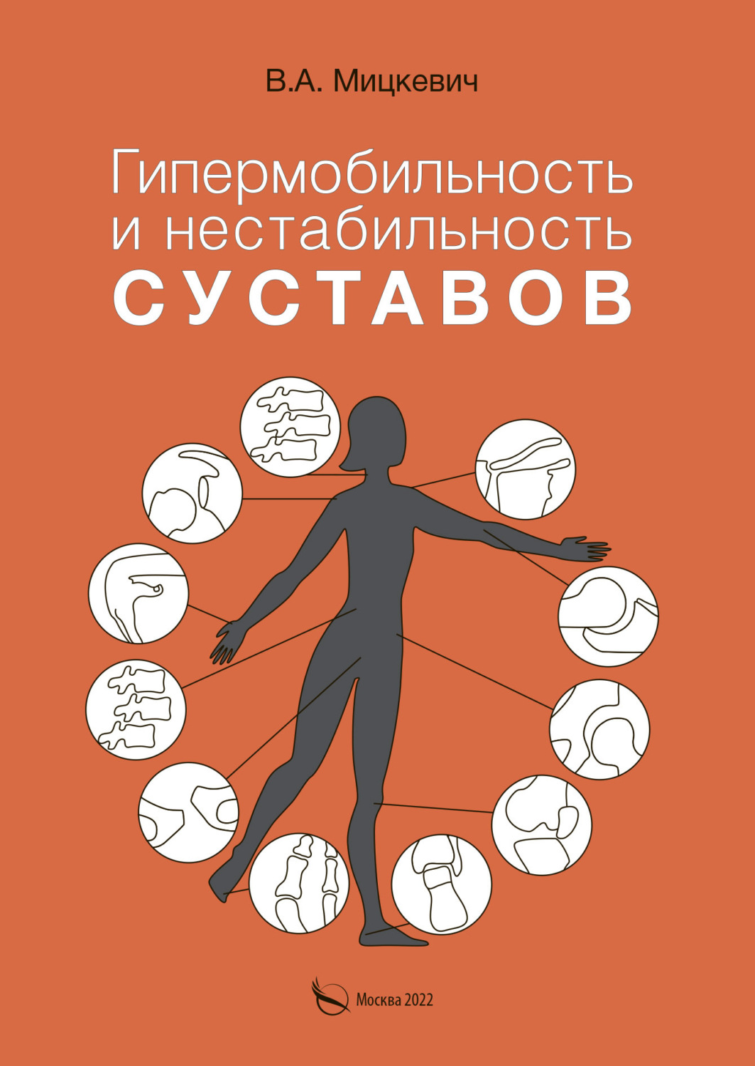 Обложка книги «Гипермобильность и нестабильность суставов»
