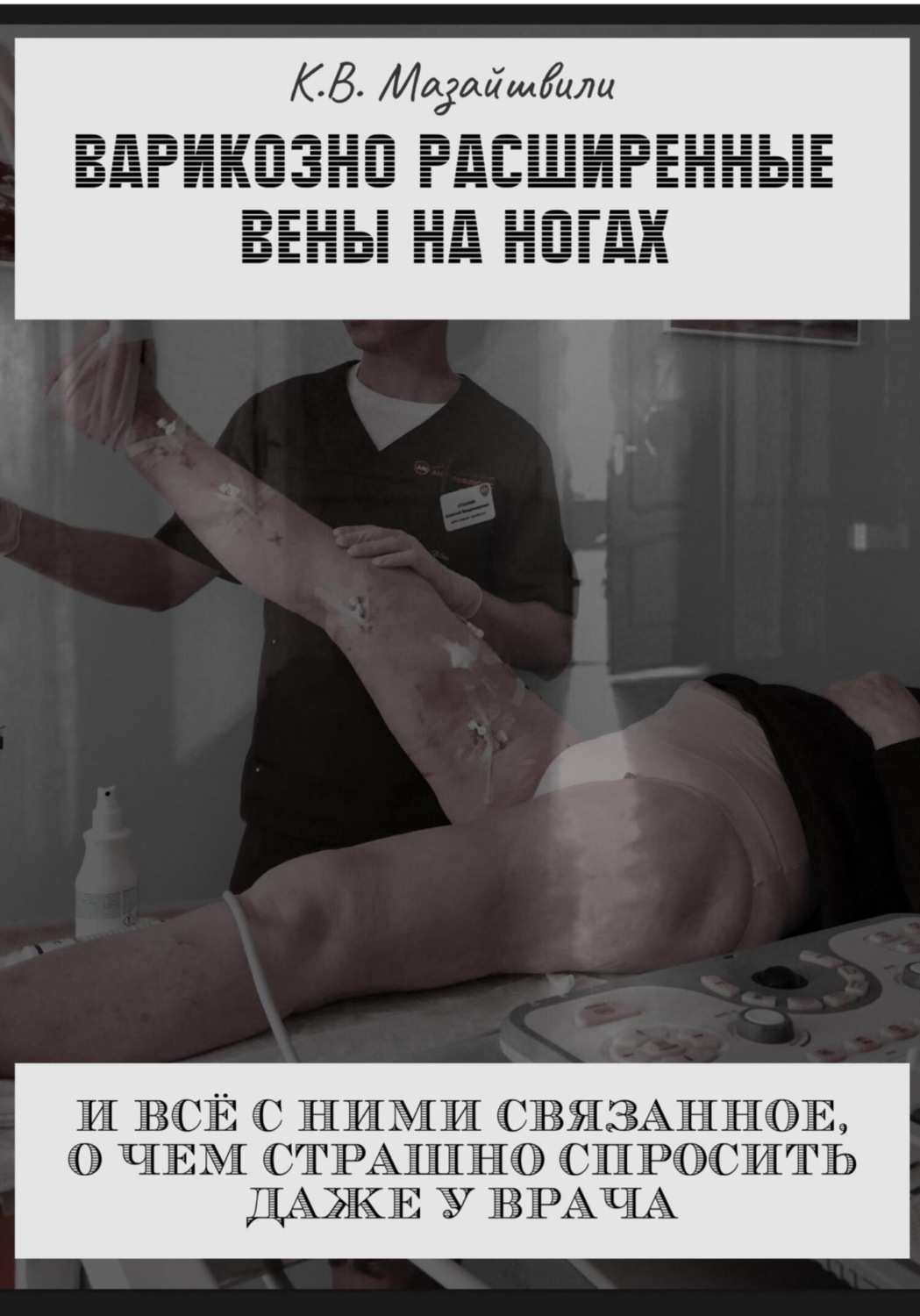 Обложка книги «Варикозно расширенные вены на ногах и всё с ними связанное, о чём страшно спросить даже у врача»