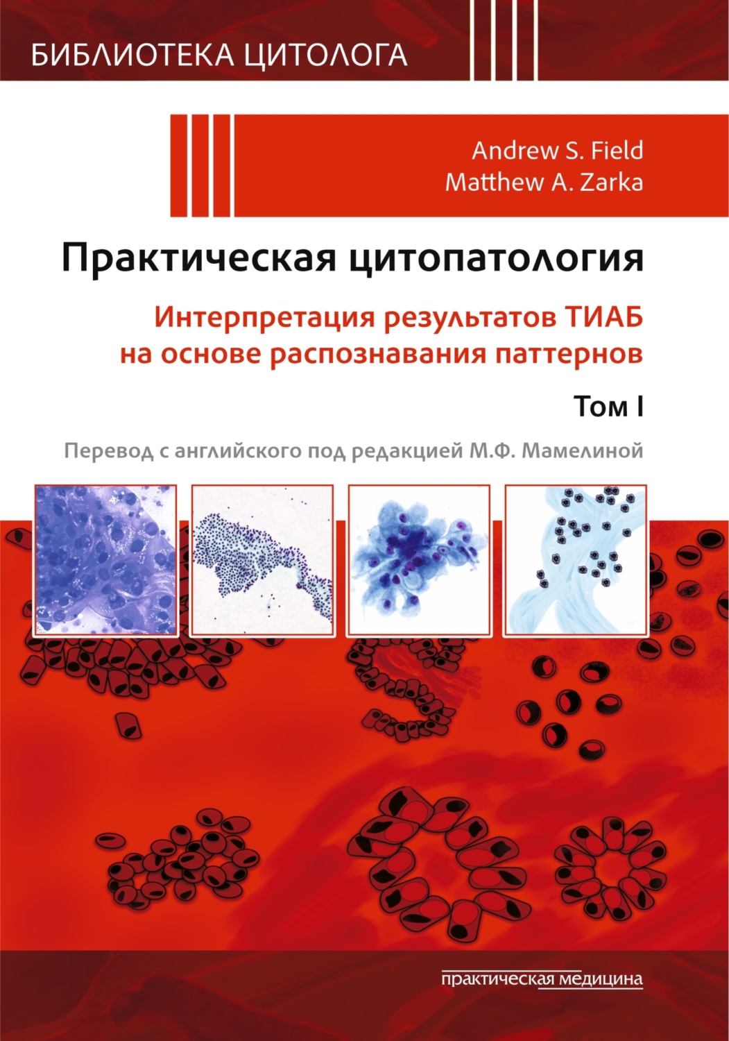Обложка книги «Практическая цитопатология. Интерпретация результатов ТИАБ на основе распознавания паттернов. Том I»