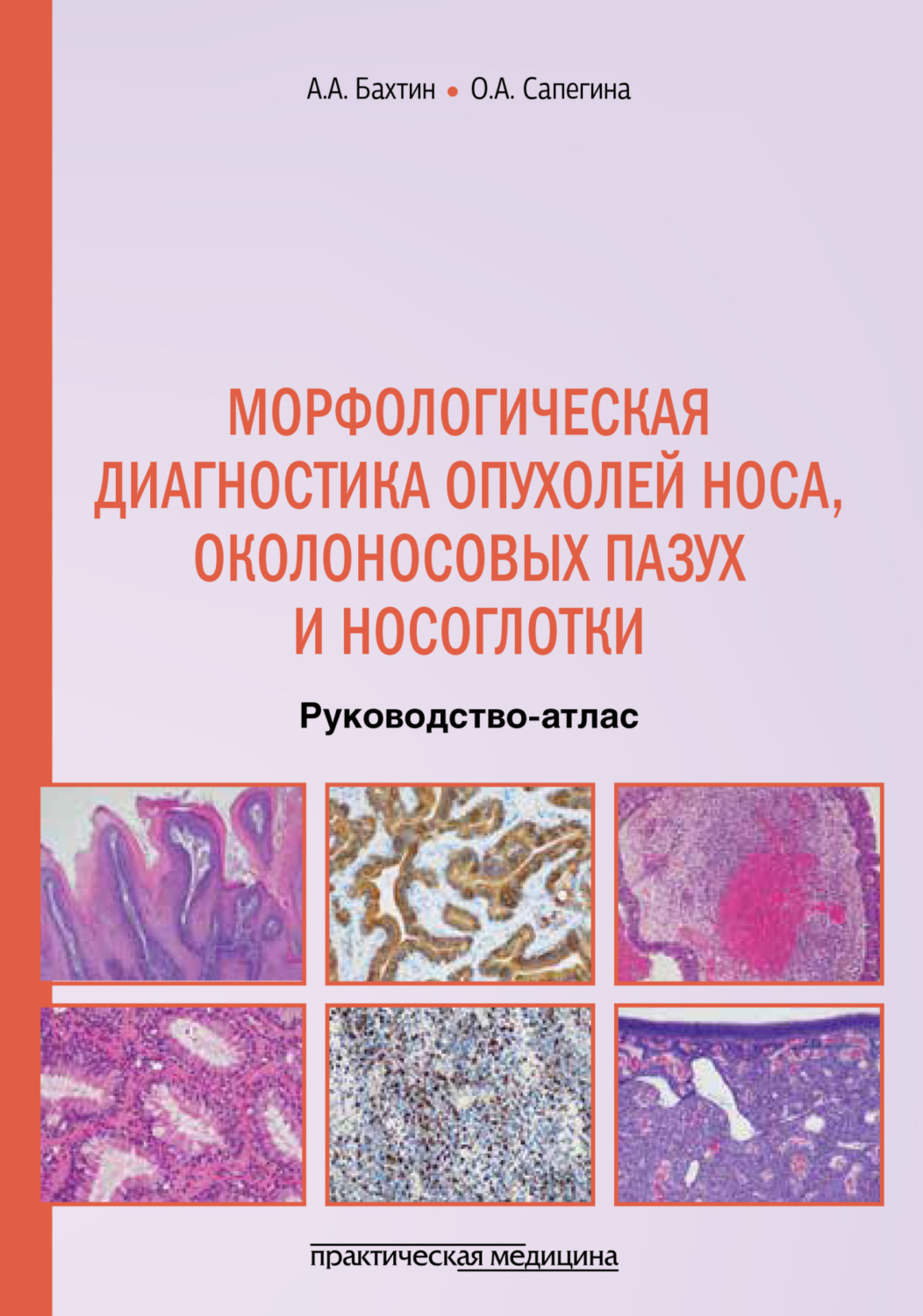 Обложка книги «Морфологическая диагностика опухолей носа, околоносовых пазух и носоглотки»