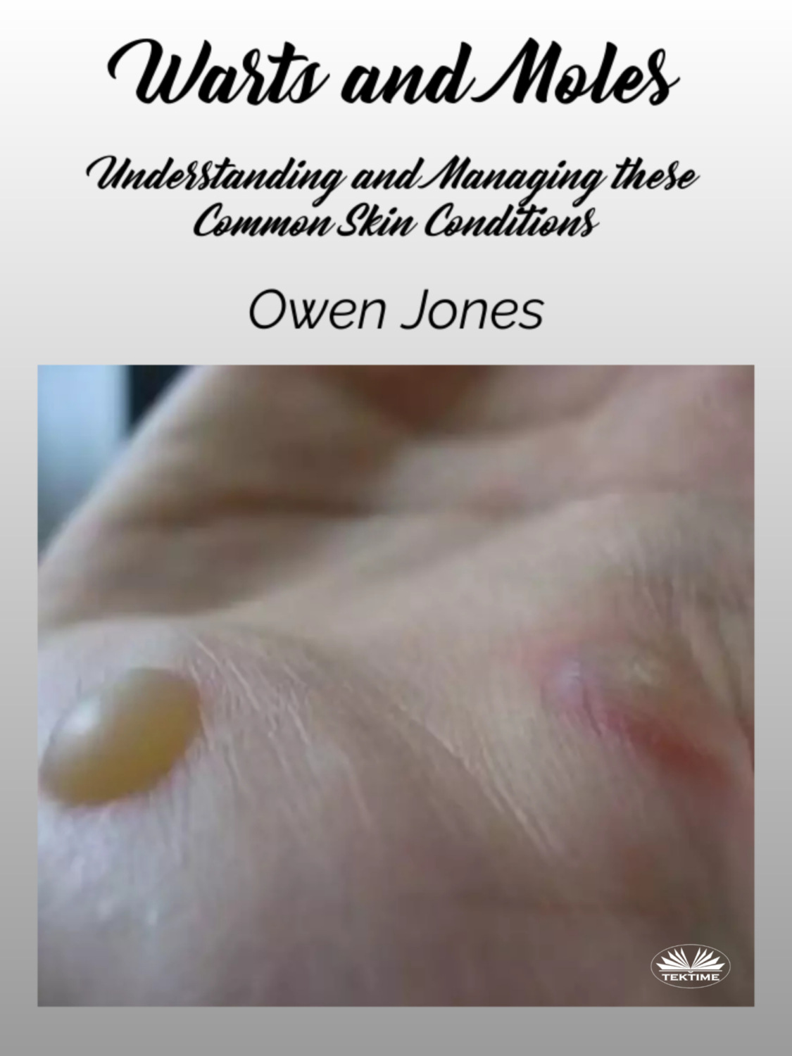 Обложка книги «Warts And Moles»