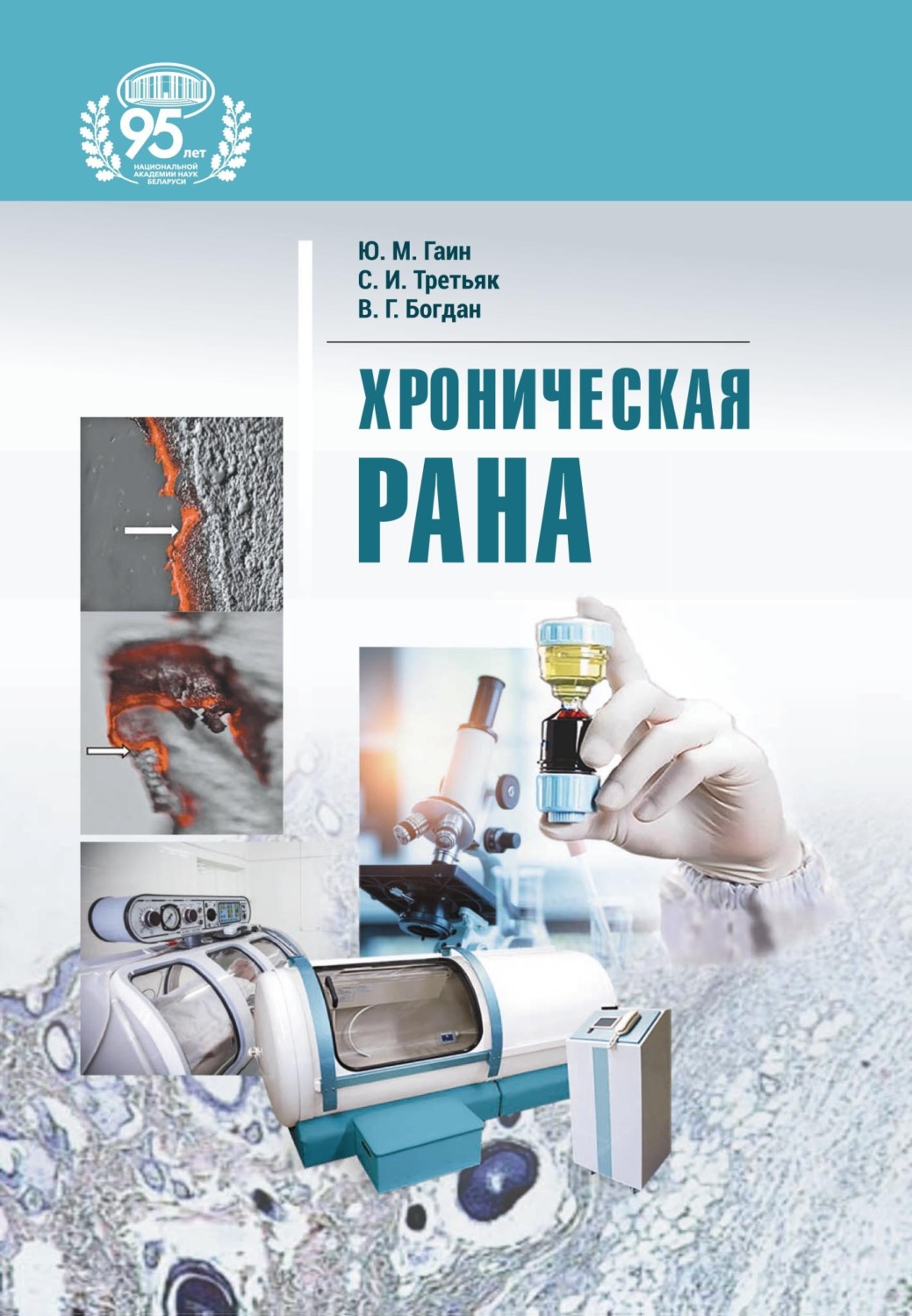 Обложка книги «Хроническая рана»