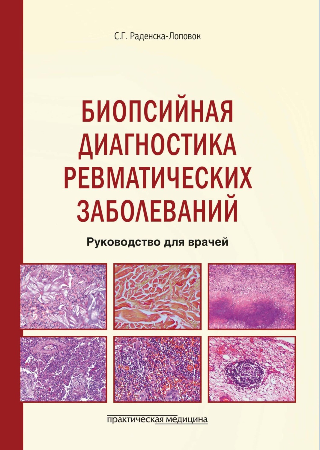 Обложка книги «Биопсийная диагностика ревматических заболеваний. Руководство для врачей»