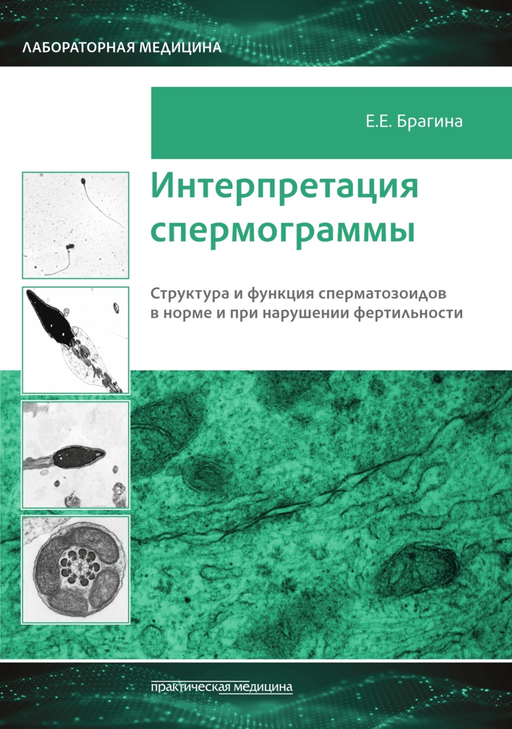Обложка книги «Интерпретация спермограммы. Структура и функция сперматозоидов в норме и при нарушении фертильности»