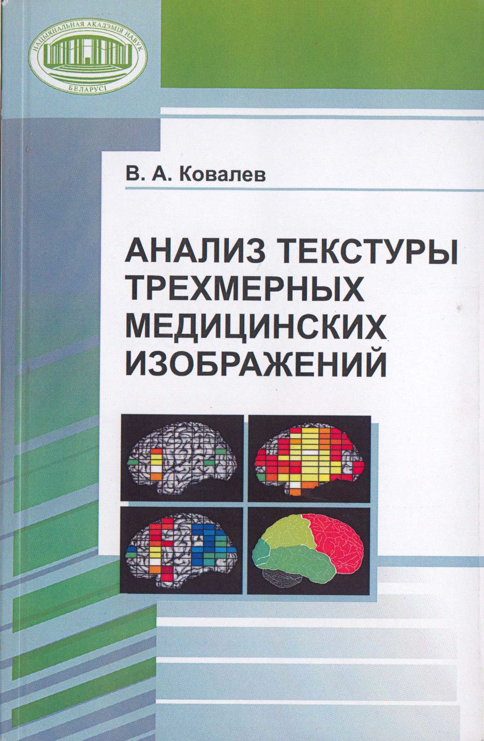 Обложка книги «Анализ текстуры трехмерных медицинских изображений»
