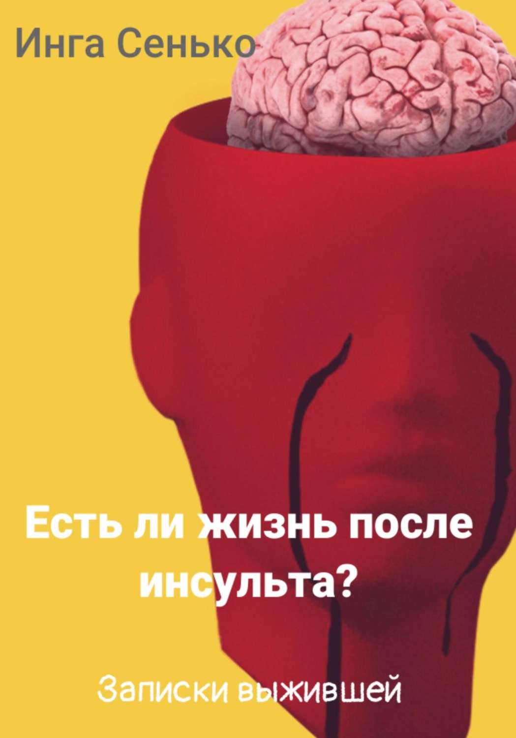 Обложка книги «Есть ли жизнь после инсульта? Записки выжившей»