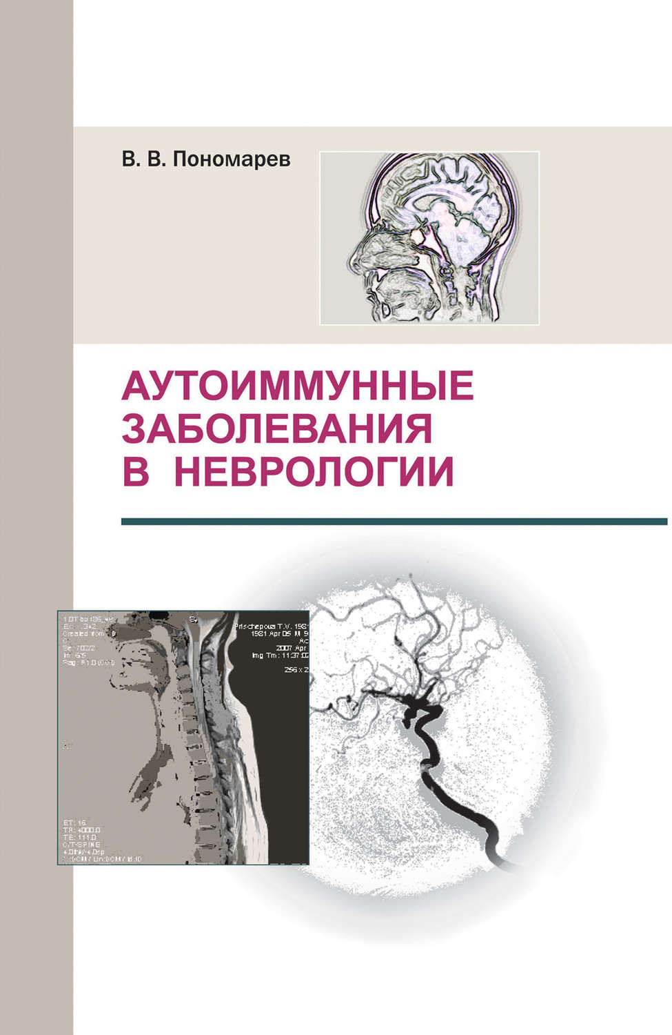Обложка книги «Аутоиммунные заболевания в неврологии»