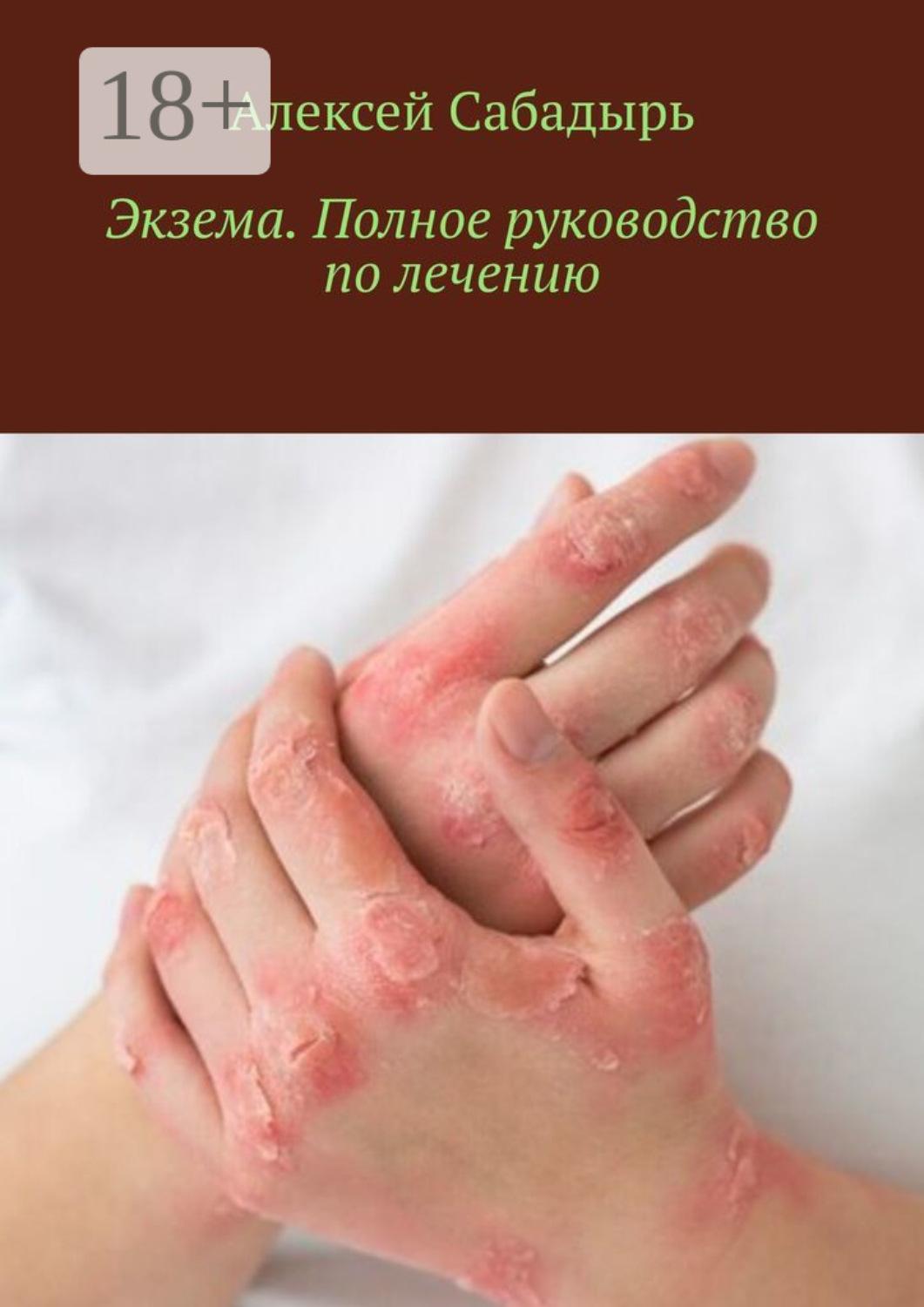Обложка книги «Экзема. Полное руководство по лечению»