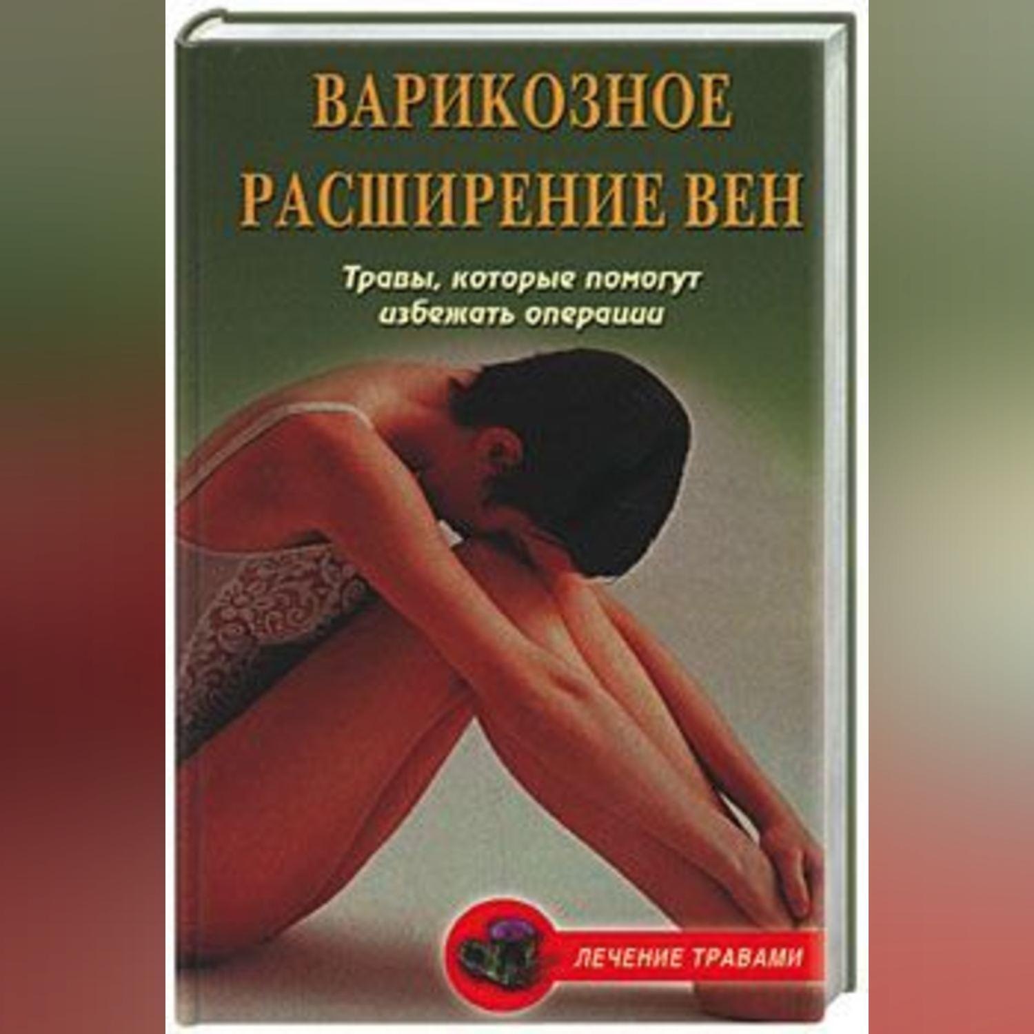 Обложка книги «Варикозное расширение вен. Травы, которые помогут избежать операции»