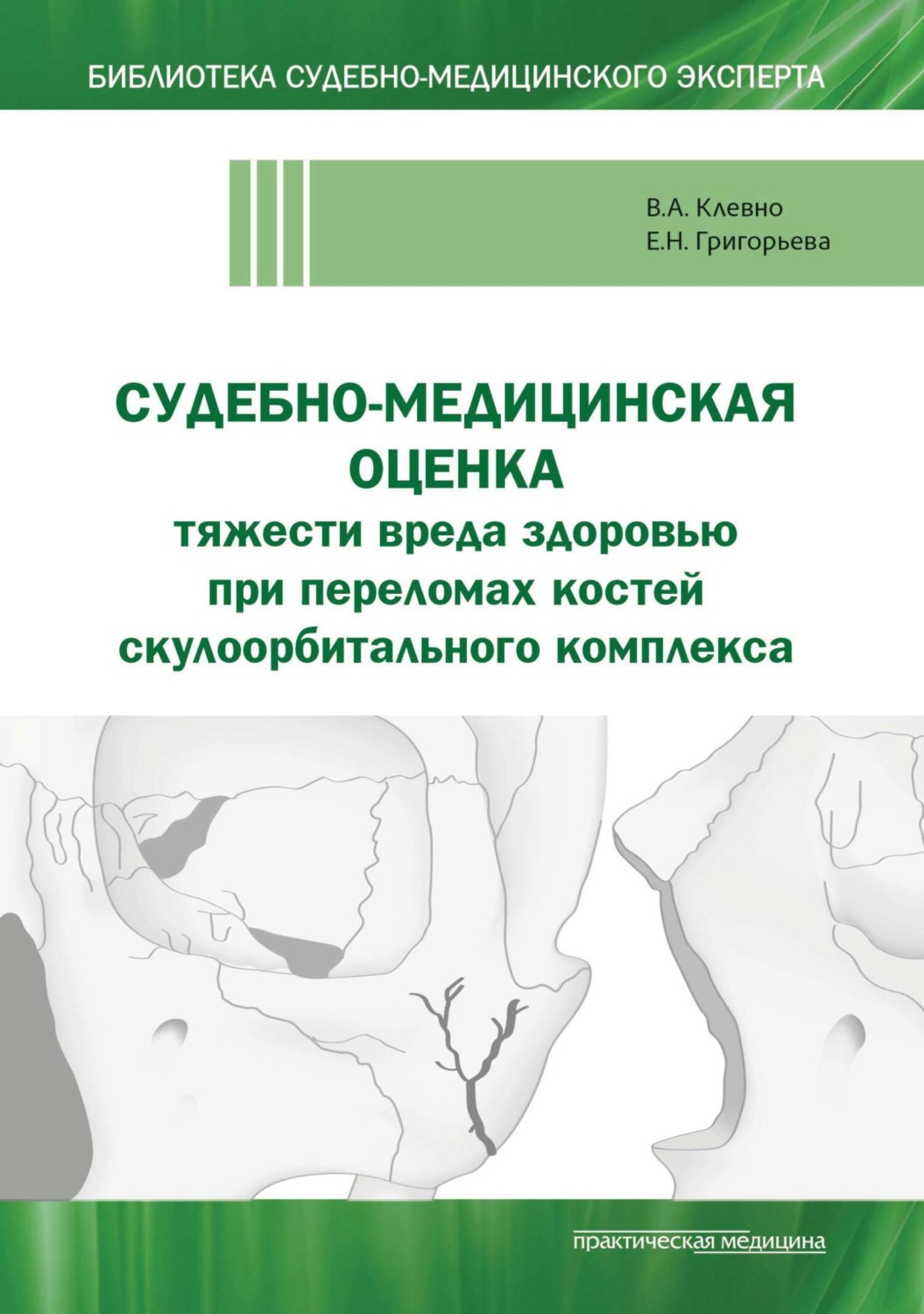 Обложка книги «Судебно-медицинская оценка тяжести вреда здоровью при переломах костей скулоорбитального комплекса»