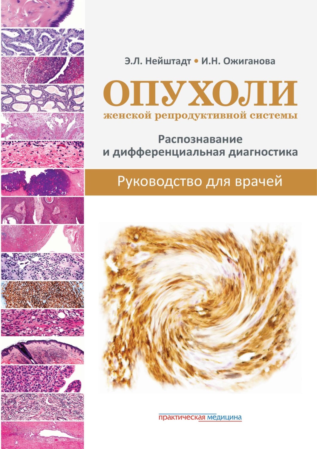 Обложка книги «Опухоли женской репродуктивной системы. Распознавание и дифференциальная диагностика. Руководство для врачей»