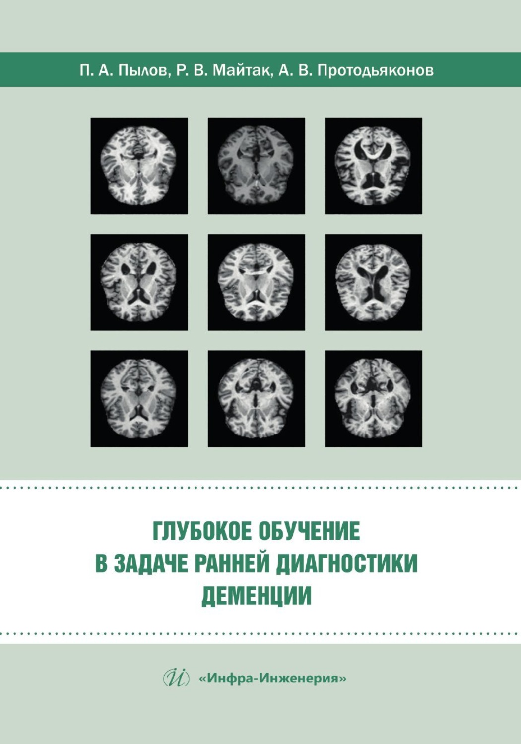 Обложка книги «Глубокое обучение в задаче ранней диагностики деменции»