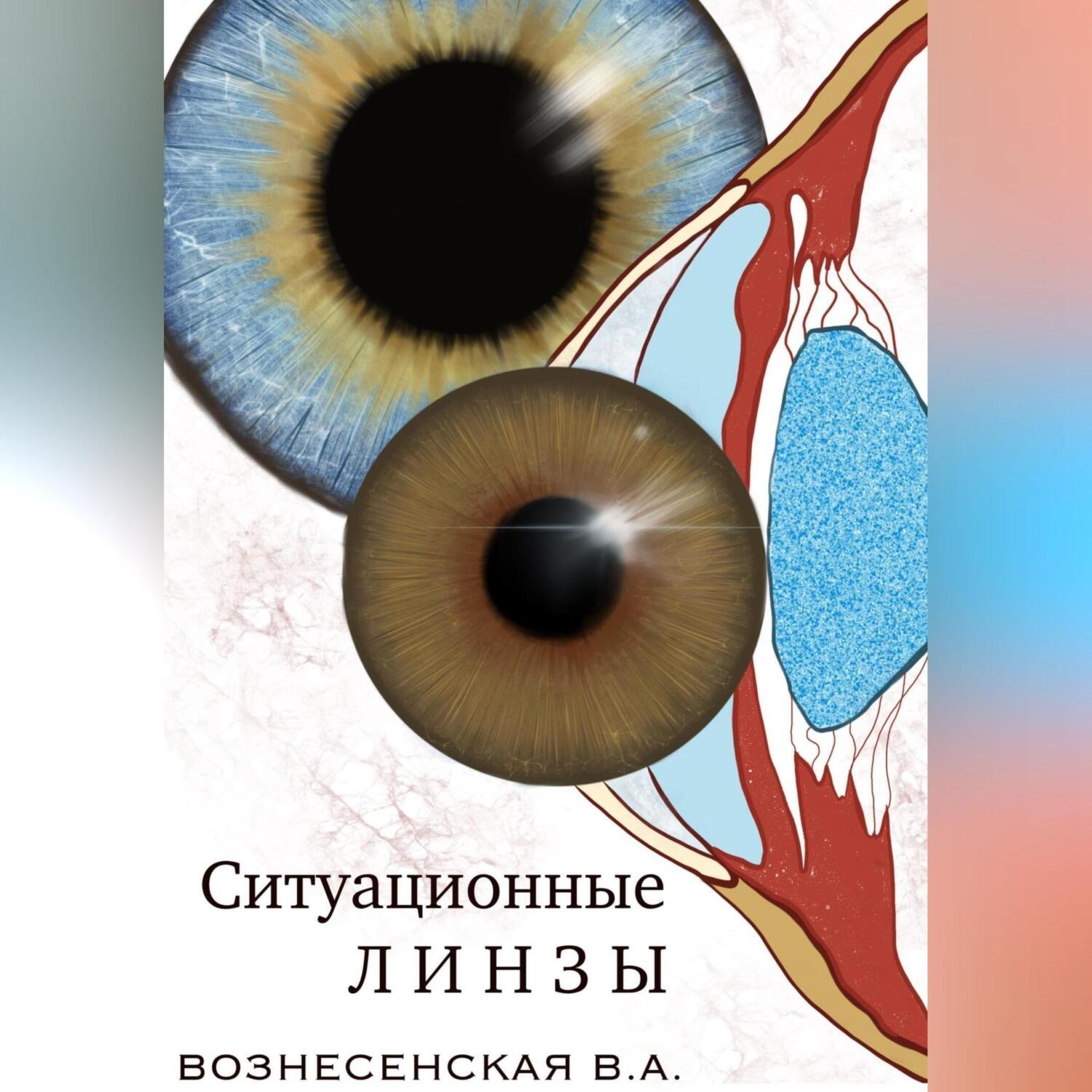 Обложка книги «Ситуационные линзы»