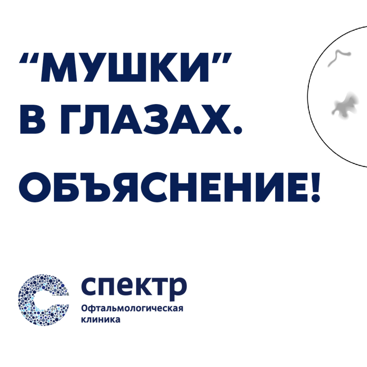 Обложка книги ««Мушки в глазах». ОБЪЯСНЕНИЕ! Реально ли избавиться?»