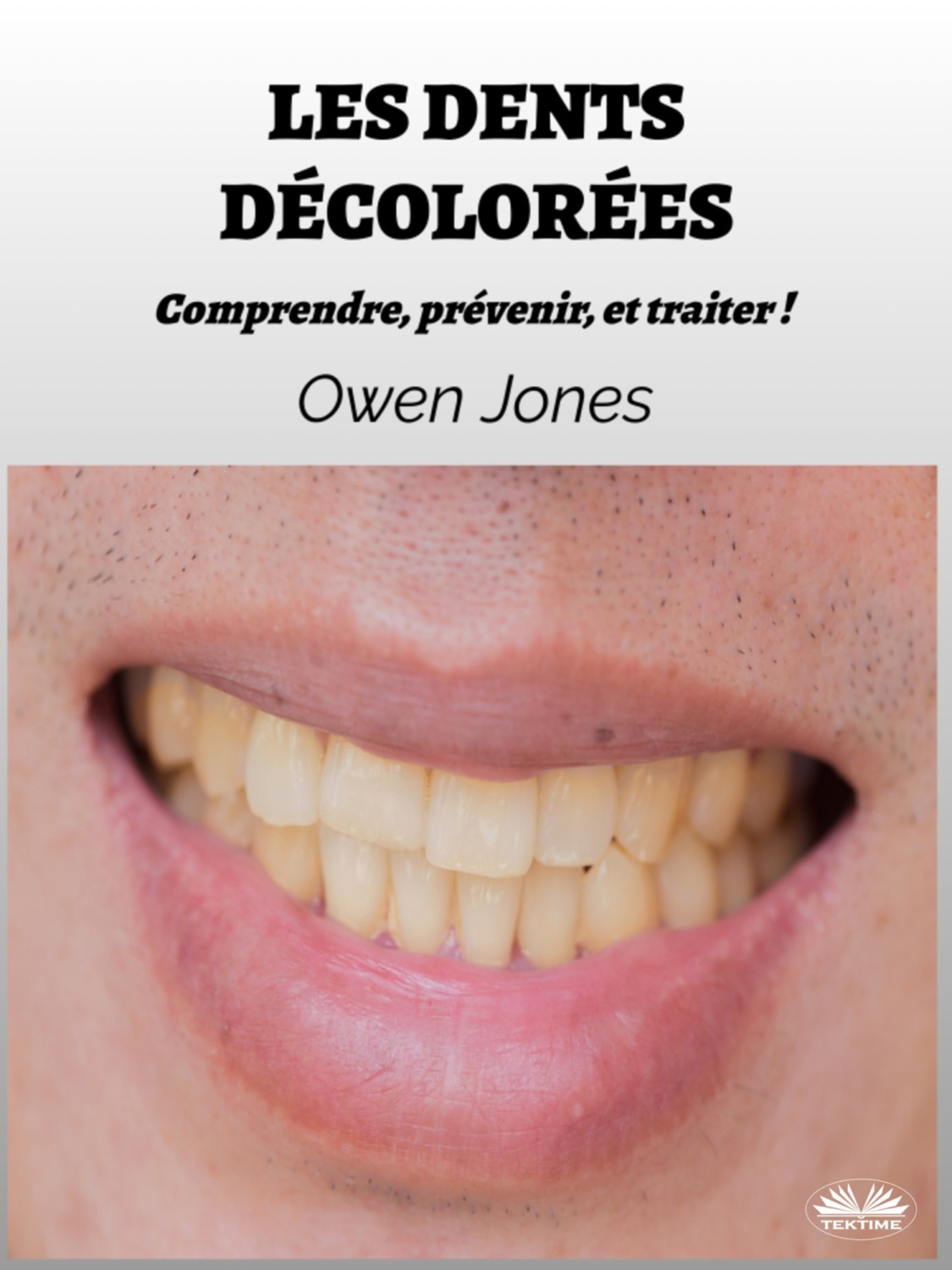 Обложка книги «Les Dents Décolorées»