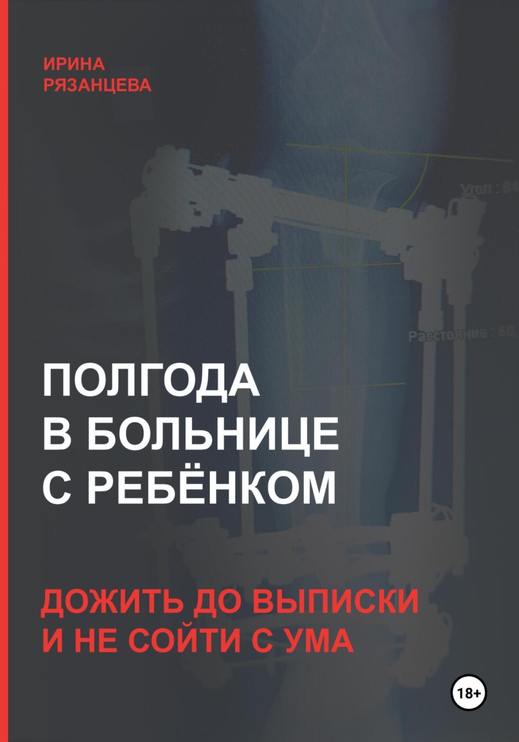 Обложка книги «Полгода в больнице с ребёнком: дожить до выписки и не сойти с ума»